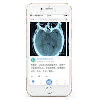 醫療影像APP開(kāi)發(fā) 提供有效治療方案